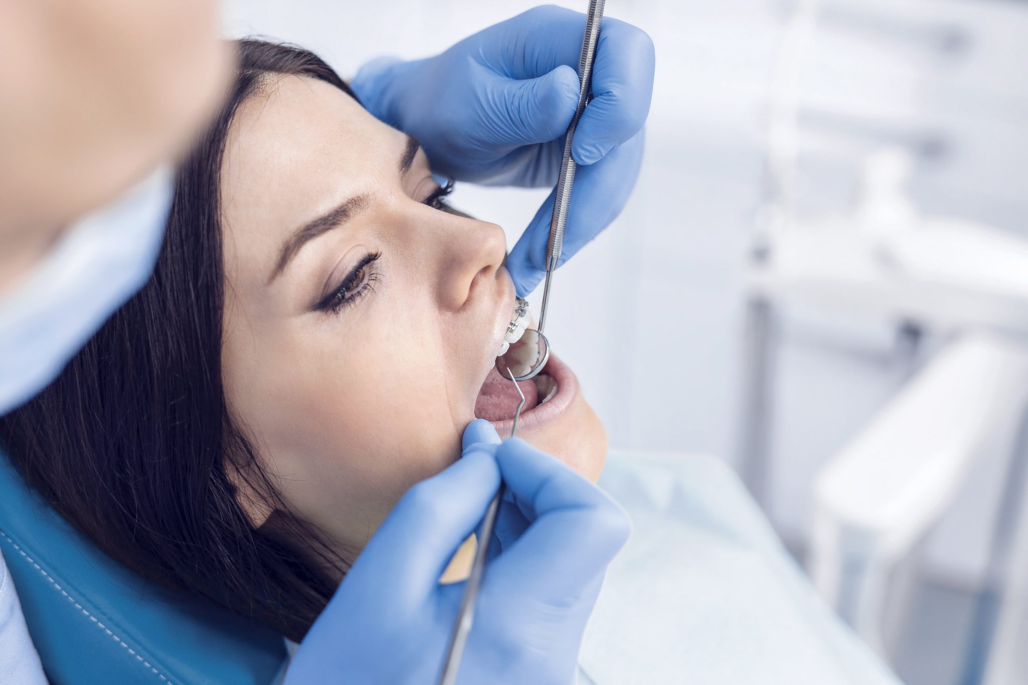 What Are The Benefits of Regular Dental Cleanings?