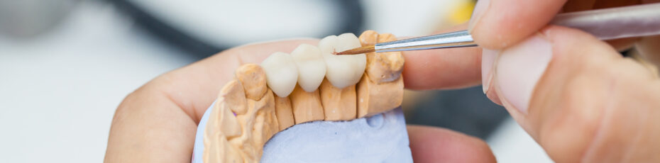 did you know dental bridges can be used to replace missing teeth