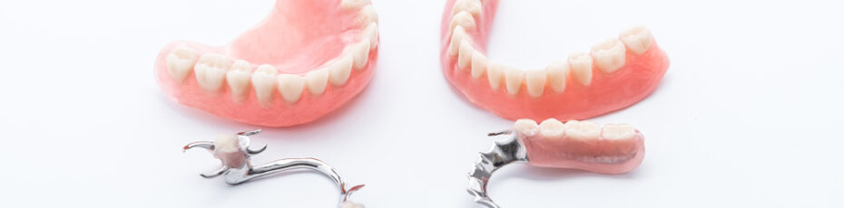 partial dentures vs dental implants which is right for you