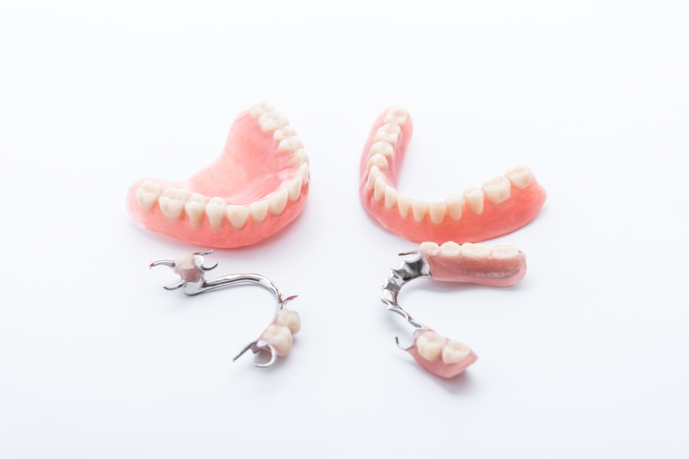 partial dentures vs dental implants which is right for you