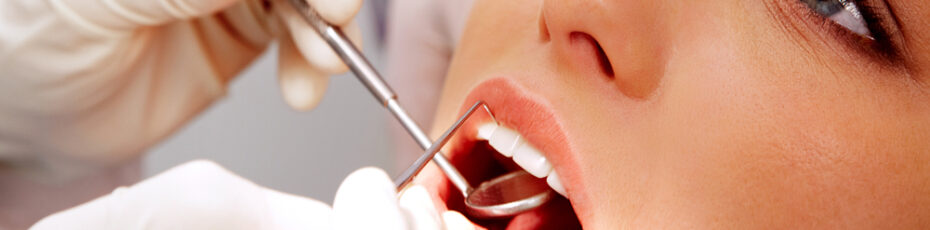 5 best alternatives to dental crowns