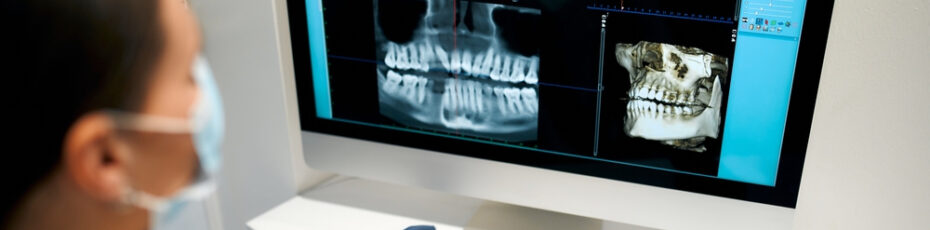 the importance of dental x-rays in oral health