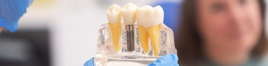 tips for maintaining your dental implants